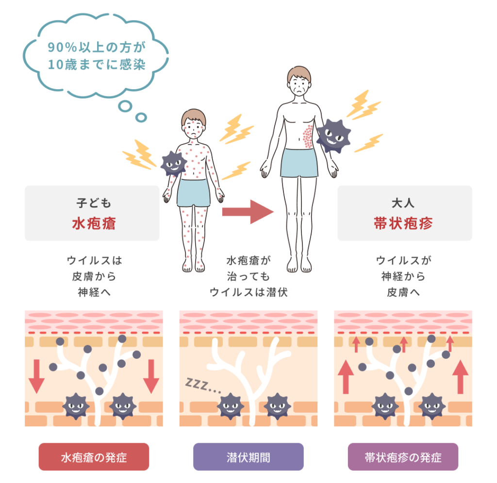 発症までの流れ